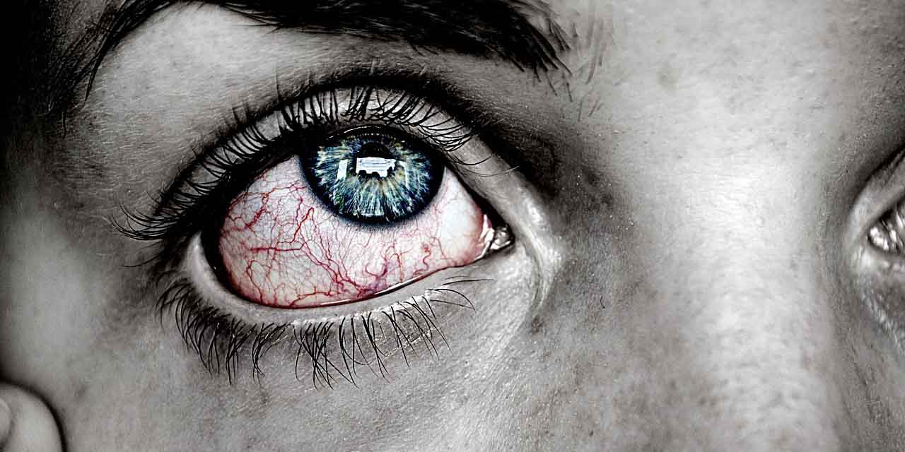 alergiczne zapalenie spojówek