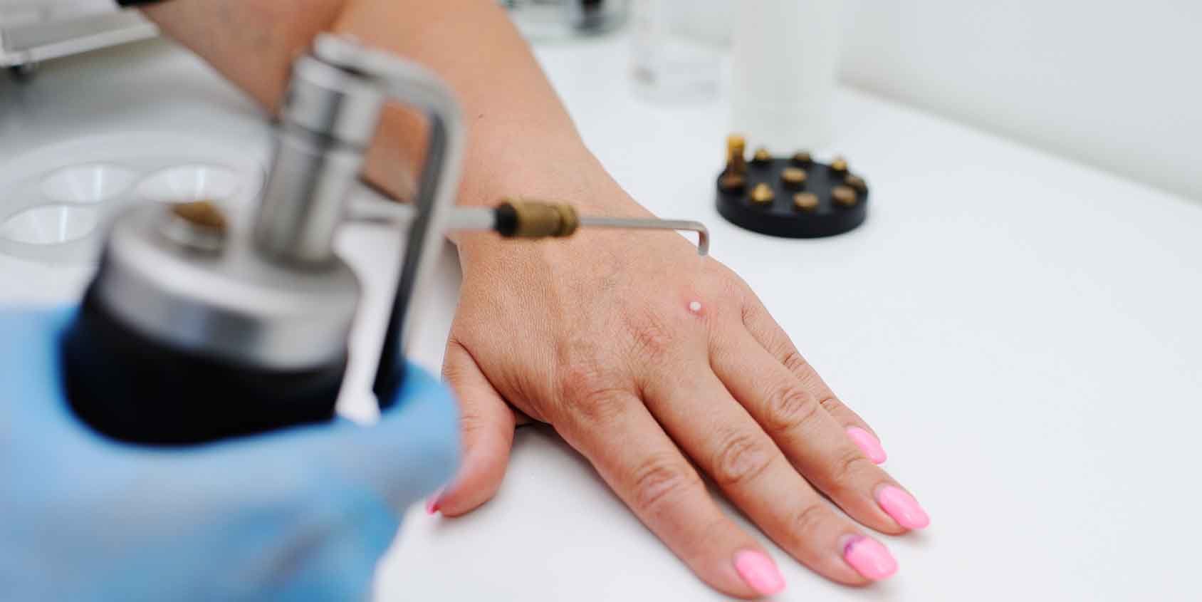 dysplazja Lewandowsky'ego-Lutza