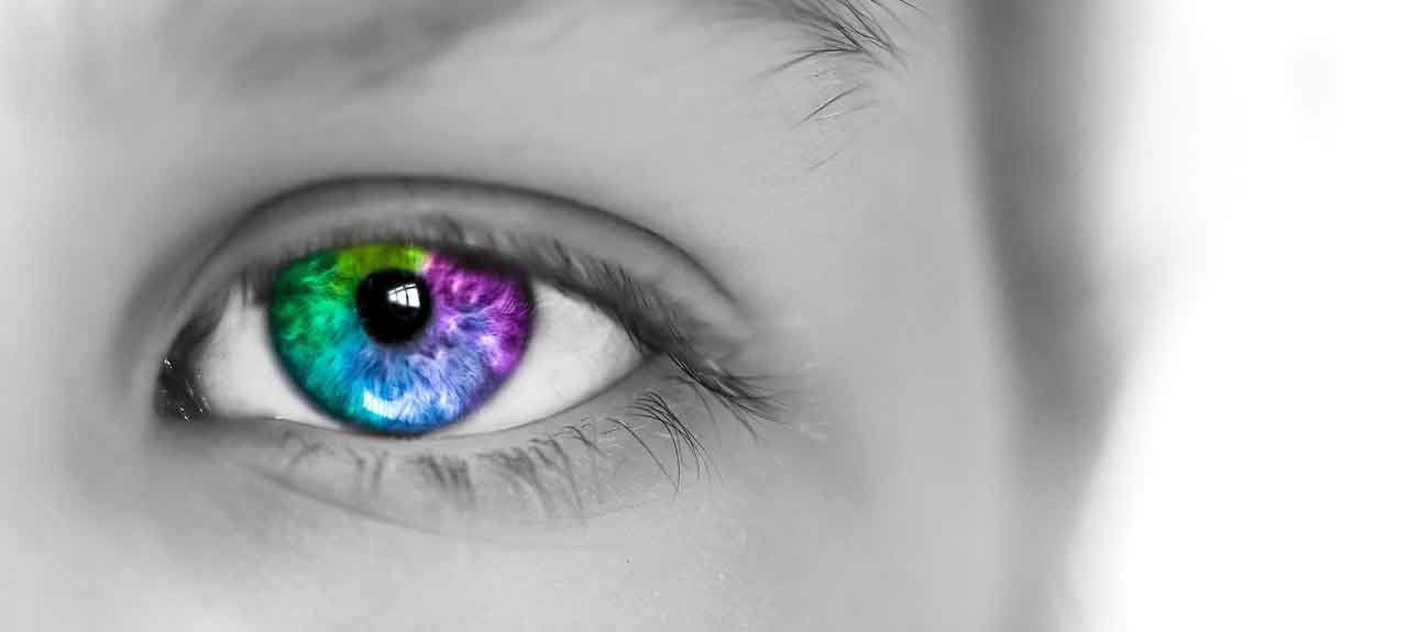 heterochromia