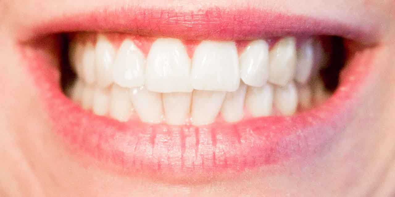 zespół alergii jamy ustnej