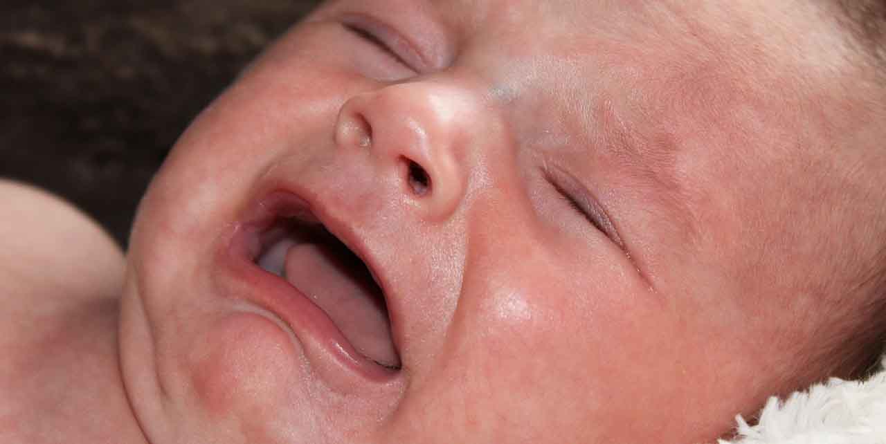 zespół Pradera-Williego