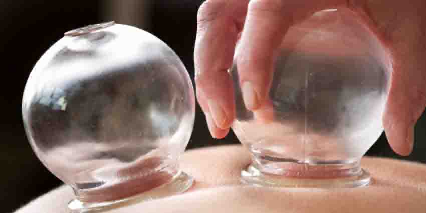 Bańki terapeutyczne