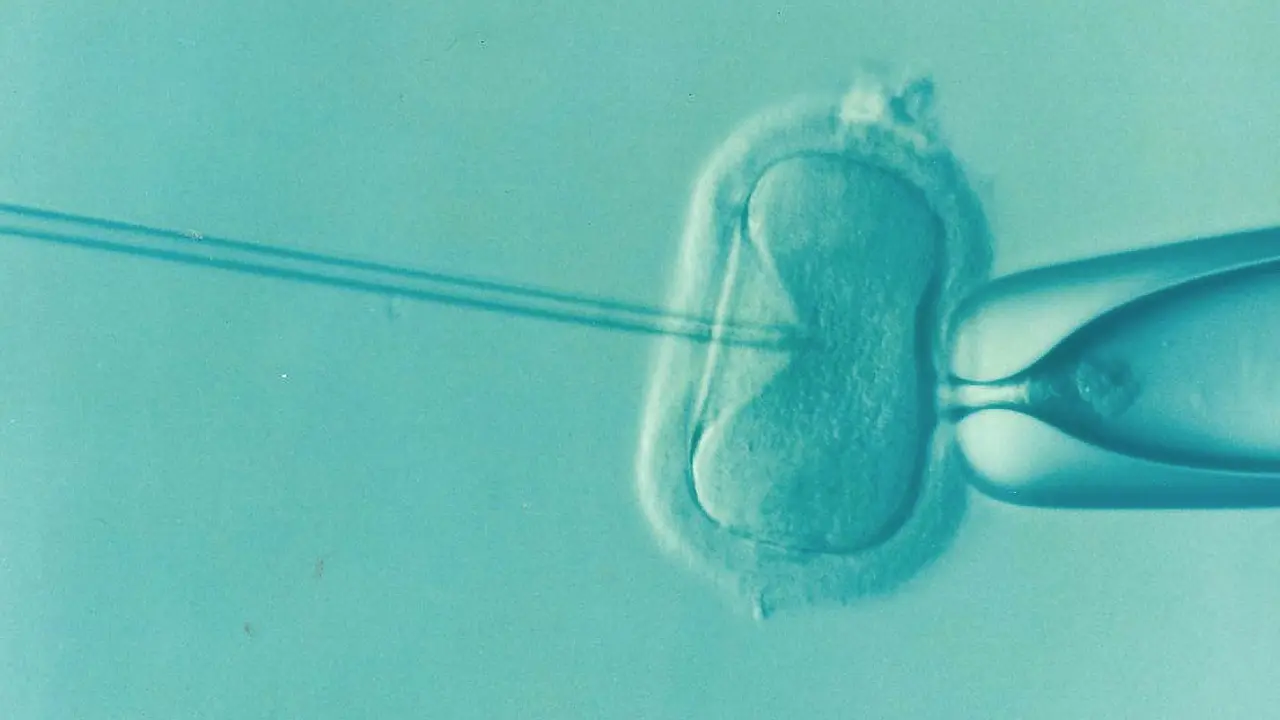 Bliźnięta dwujajowe z in vitro, czyli jak rodzą się bliźniaki?
