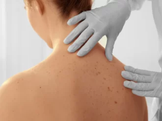 Dermatologia – jakie choroby najczęściej leczy dermatolog?