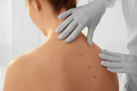 Dermatologia – jakie choroby najczęściej leczy dermatolog?