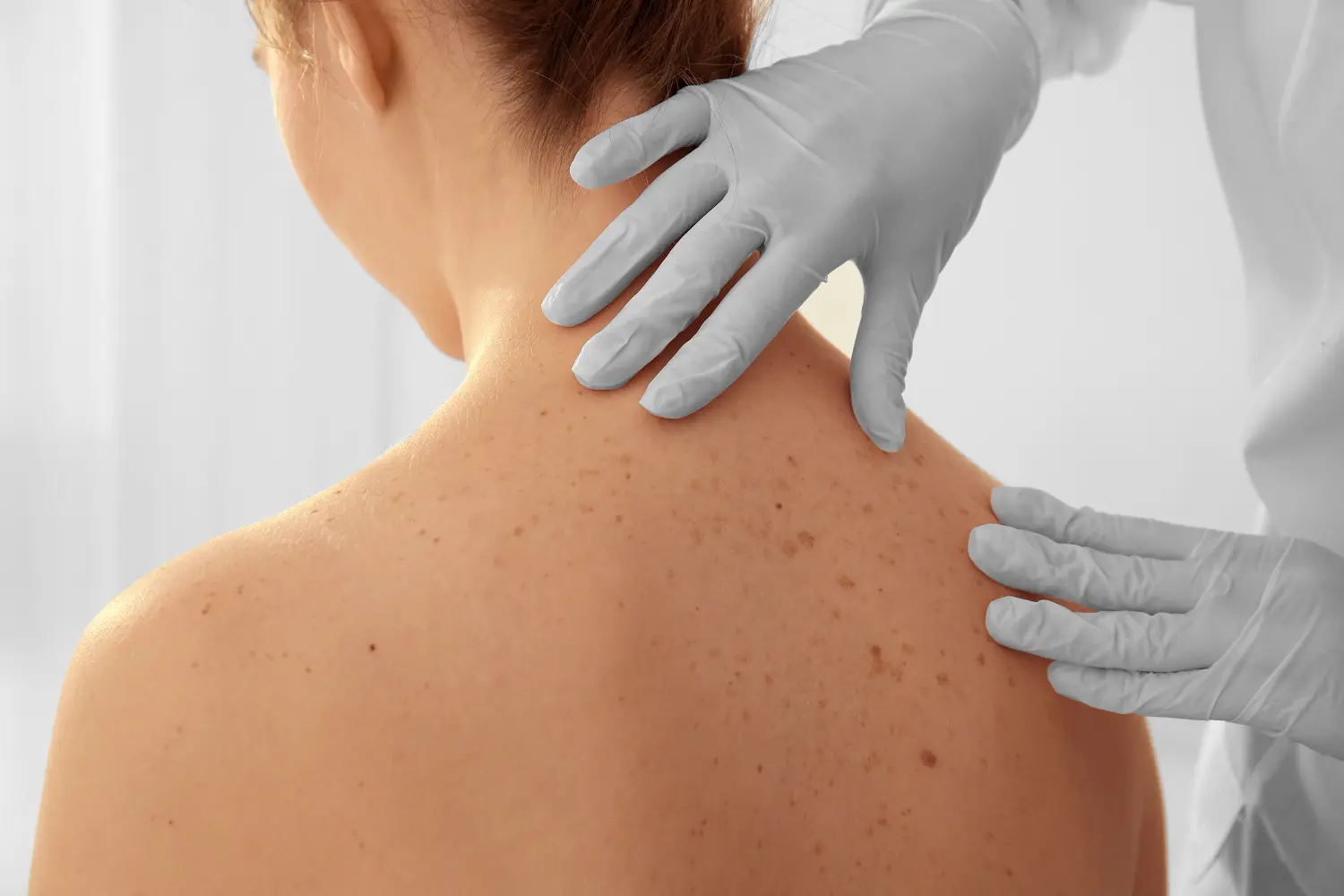Dermatologia – jakie choroby najczęściej leczy dermatolog?