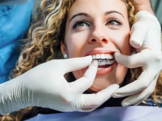 Niewidoczne nakładki ortodontyczne